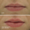 perfecting gloss before after