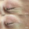 PolyPeptide Collagel + Mask for eyes - Патчі для зони навколо очей-5 PolyPeptide Collagel + Mask for eyes - Патчі для зони навколо очей-5