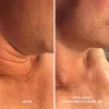 Firm-A-Fix Nectar - Лифтинг-сыворотка для шеи и декольте-2