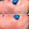Collagen reactivate pm before - after 2