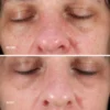 Collagen reactivate pm before - after 3