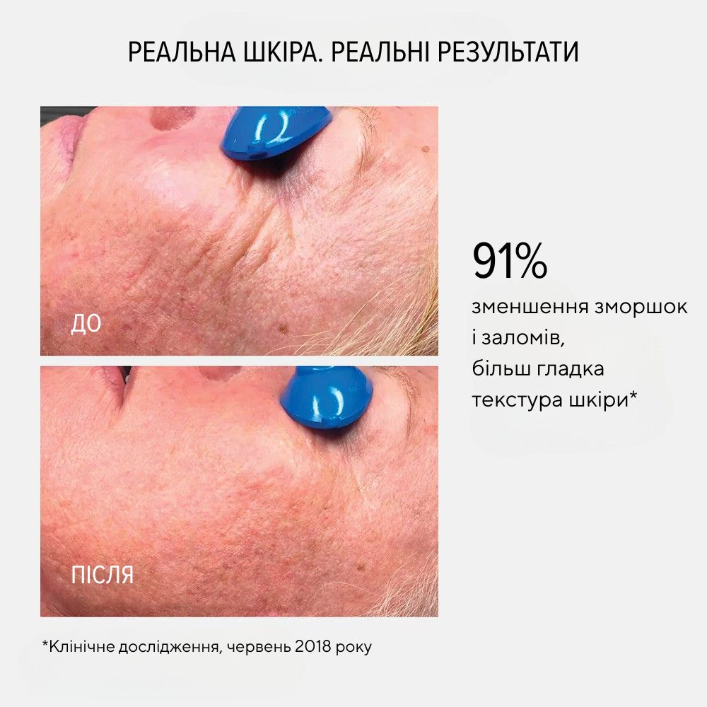 Collagen reactivate pm before - after